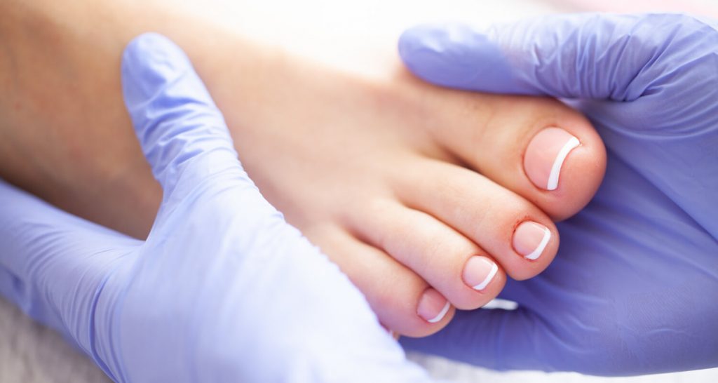 Woman showing feet for podiatrist